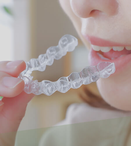 マウスピースを装着しようとする女性の口元